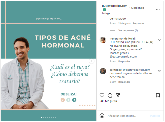 Tipos de acné hormonal según @gustavogarriga.com(Foto. Instagram)