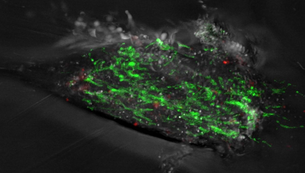 Fibroblasto de paciente de párkinson, con mitocondrias (verde) y fragmentos de mitocondrias dañadas (rojo) (Foto: IIBB-CSIC)