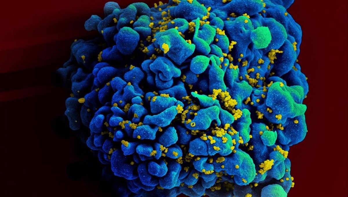 Escaneo electromicrográfico de una célula T infectada con VIH (Foto. NIAID)