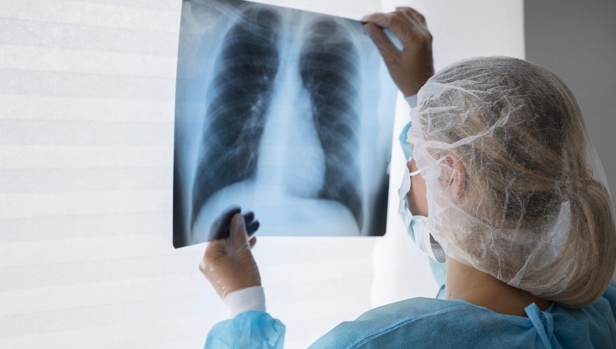 Radiografía de los pulmones (Foto. Freepik)