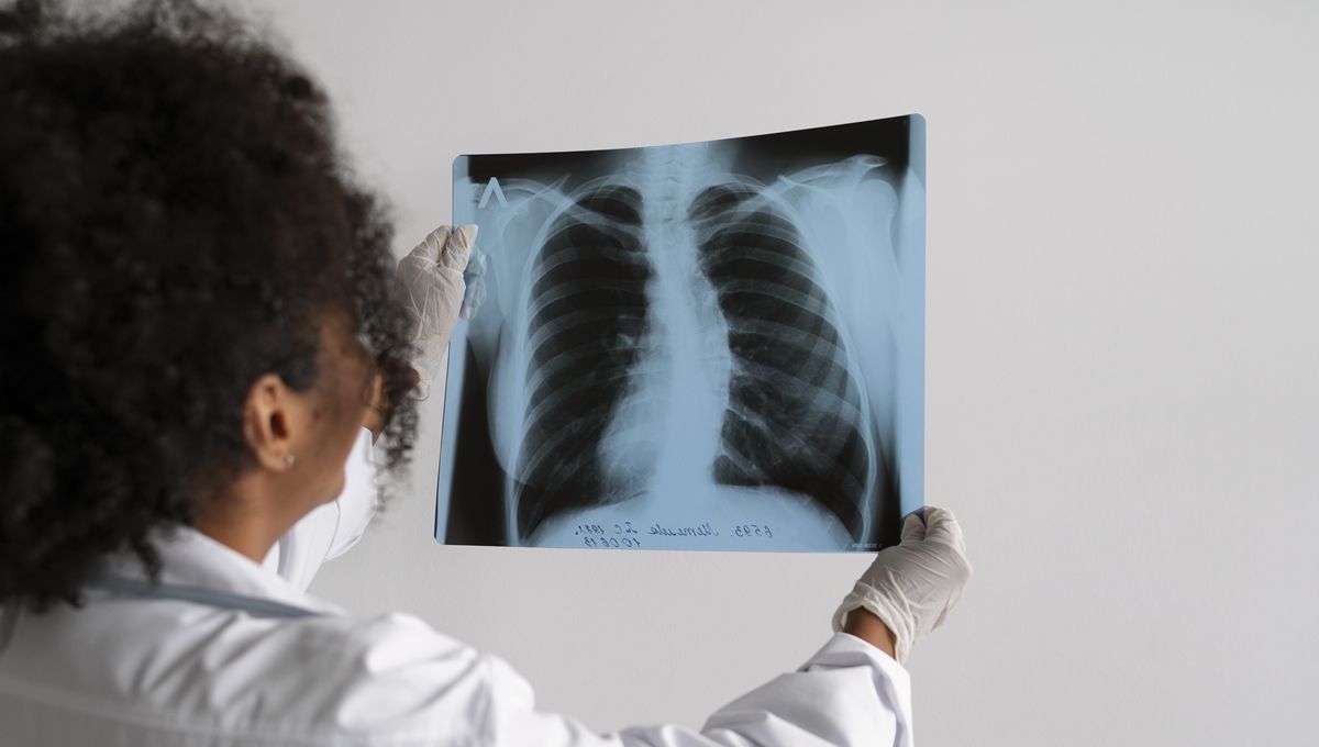 Un ensayo analizará si unos parches cutáneos pueden emplearse para identificar el rechazo en trasplantes de pulmón (Foto. Freepik)