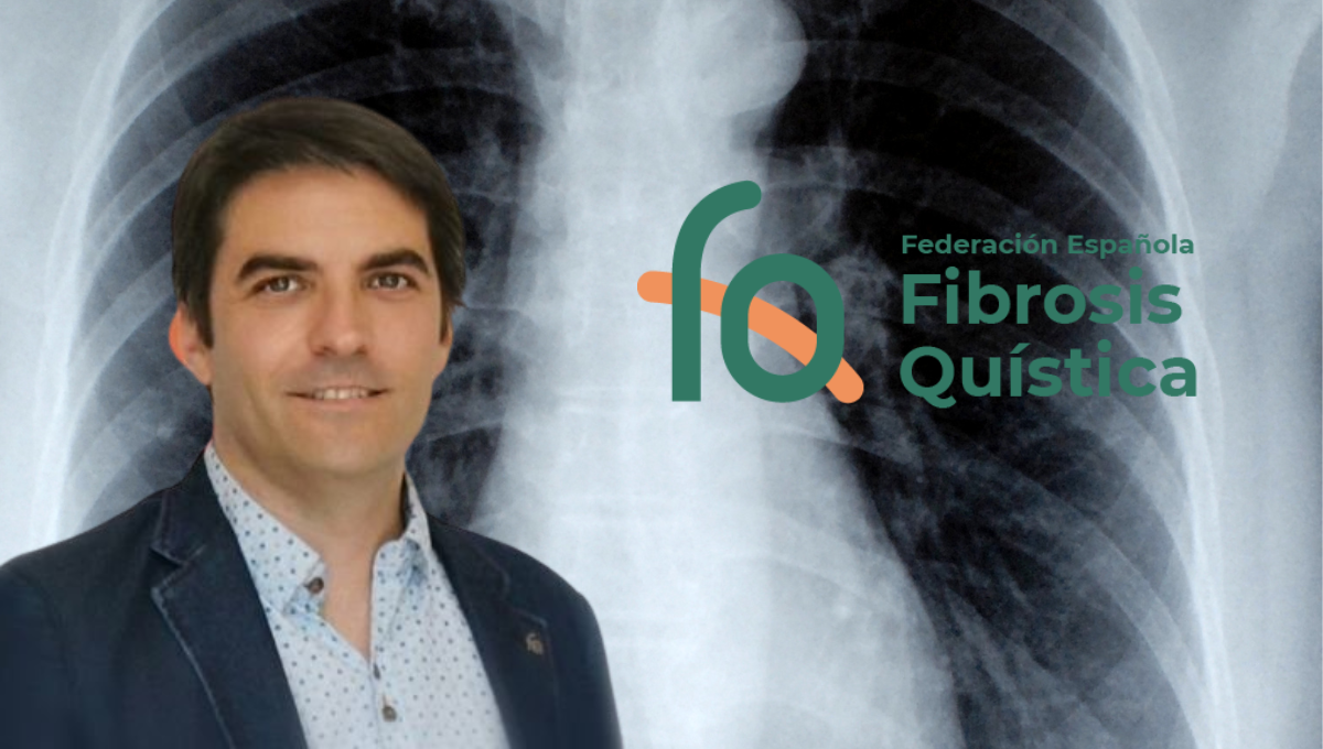 El presidente de la Federación Española de Fibrosis Quística, Juan Da Silva, describe en ConSalud.es la situación actual de la fibrosis (Foto. Montaje)