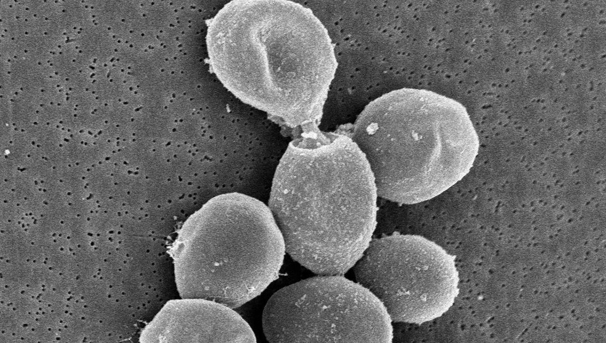 Imagen al microscopio electrónico de la levadura Saccharomyces cerevisiae durante el proceso de envejecimiento del cava (Foto: CSIC)