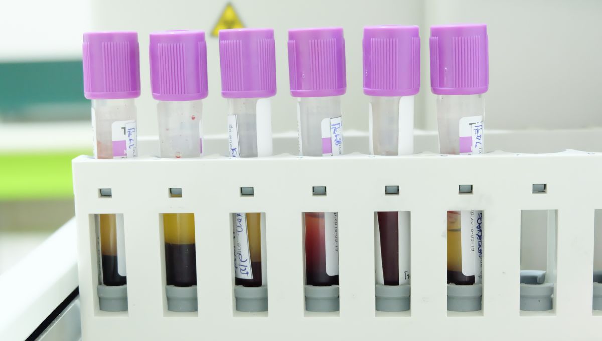 Muestras de sangre en laboratorio (Fuente Canva)
