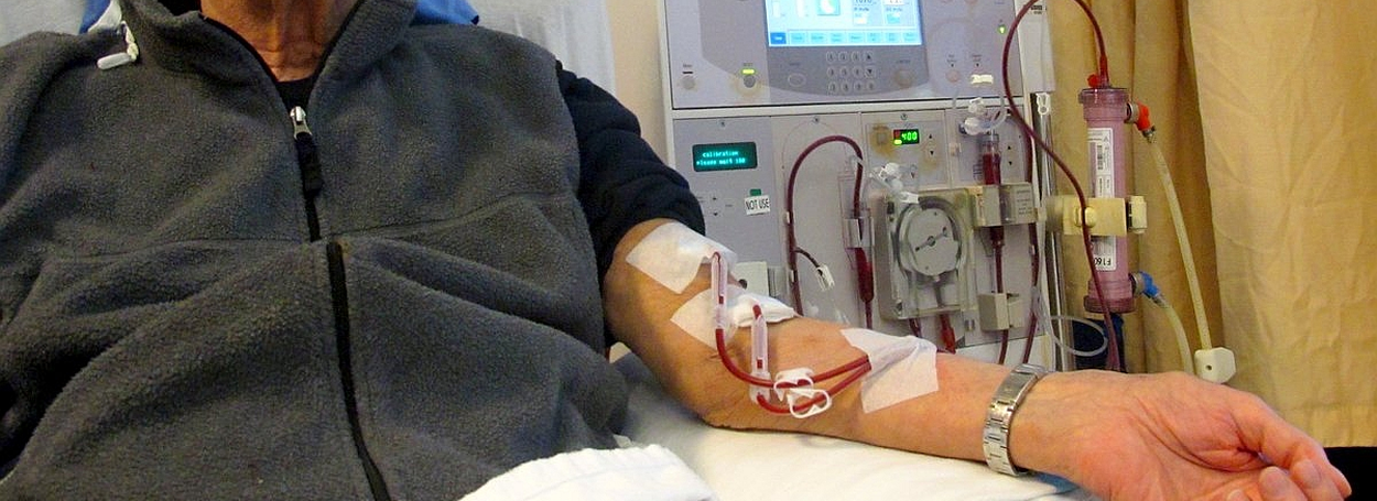 La administración de hierro intravenoso es común en los pacientes en diálisis, ya que la anemia es una de las complicaciones médicas más frecuentes en las personas con enfermedad renal crónica.