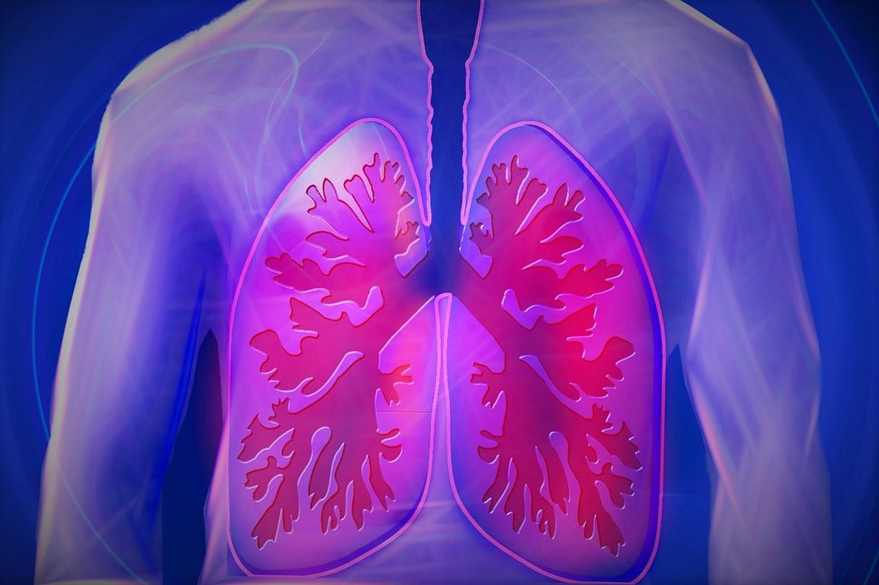 Expertos han debatido sobre el síndrome dedificultad respiratoria aguda e hipoxemia refractaria