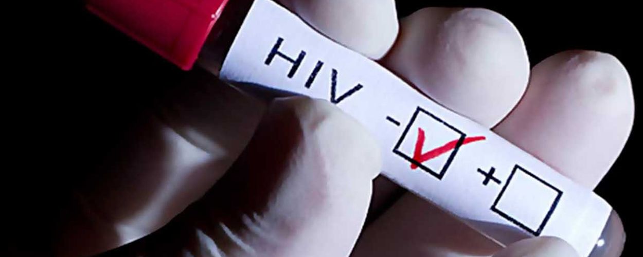 Las pruebas para el autodiagnóstico del VIH se podrán adquirir en farmacias sin necesidad de prescripción médica