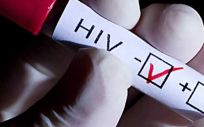 Las pruebas para el autodiagnóstico del VIH se podrán adquirir en farmacias sin necesidad de prescripción médica