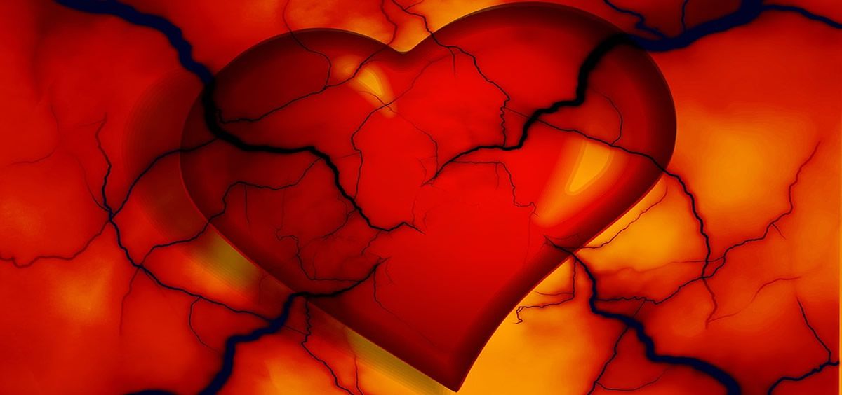 Las cardiopatías congénitas complejas representan del 12 al 15% de los casos aunque son un grupo con una alta demanda asistencial