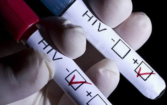 Sólo un 1% de las farmacias españolas ofrecen la prueba rápida del VIH