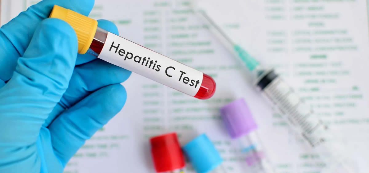  A final de 2017 se habían tratado alrededor de 2.360 pacientes afectados con Hepatitis C 