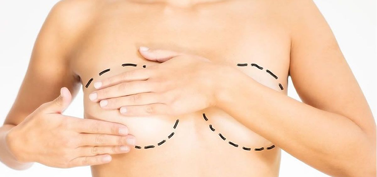 Cáceres realiza la primera reconstrucción de mama con piel y grasa abdominal