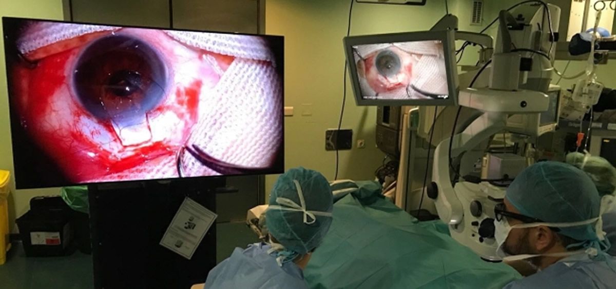 El Clínico de Zaragoza añade nueva técnica para tratar el glaucoma