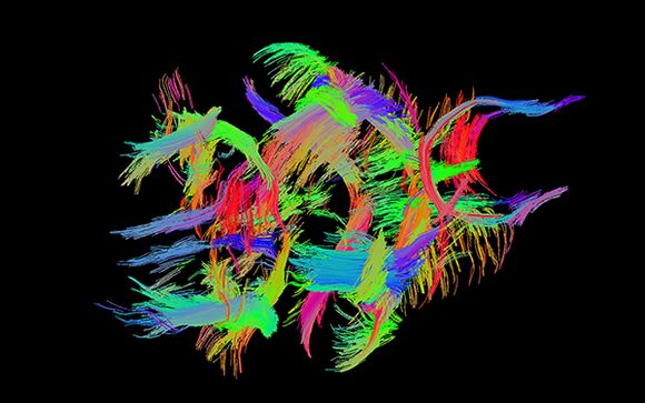 Tractografía que reproduce los haces de sustancia blanca del cerebro de un ratón. / NIH. En la parte de abajo, las imágenes corresponden al cerebro de una rata tras una isquemia cerebral tomadas con resonancia magnética nuclear. / UCM.