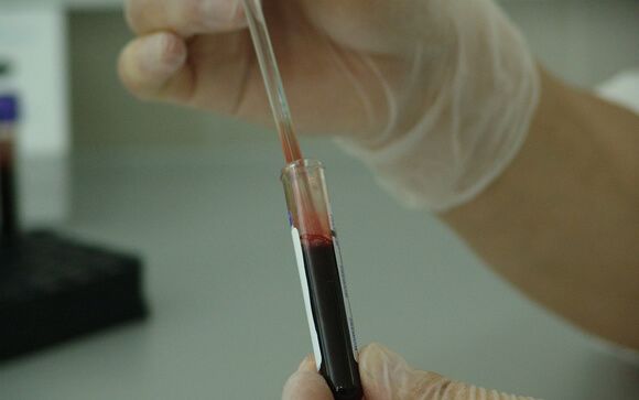 En España alrededor de 3.000 personas padecen hemofilia