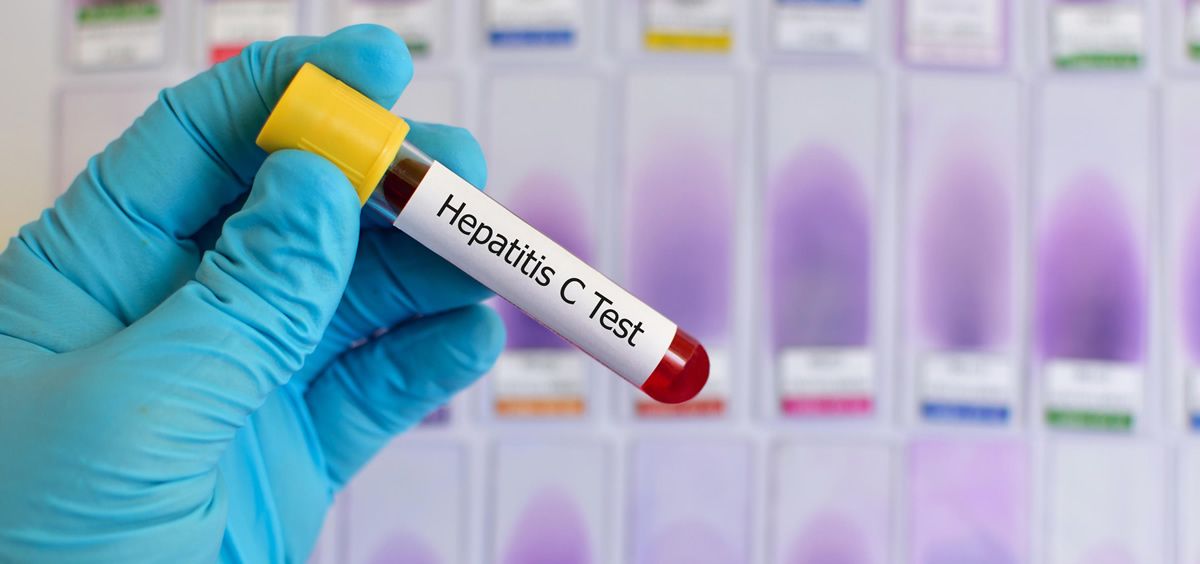 Los pacientes con hemofilia contagiados de hepartitis C en Andalucía aún no han recibido indemnizaciones