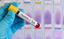 Los pacientes con hemofilia contagiados de hepartitis C en Andalucía aún no han recibido indemnizaciones