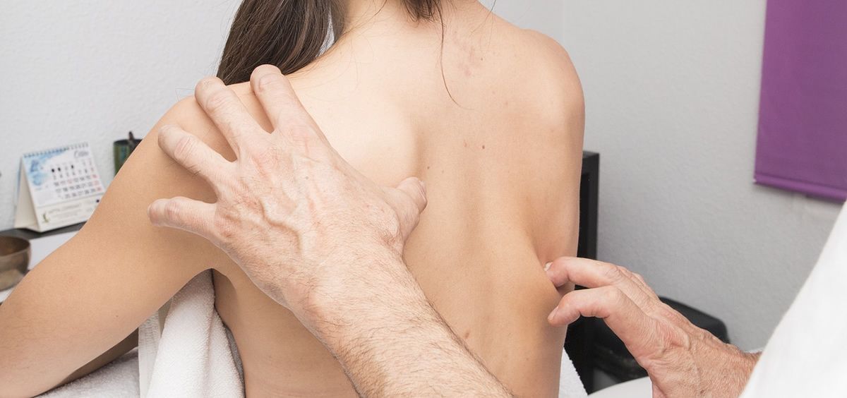 Los especialistas consideran fundamental consultar con un dermatólogo antes de intentar eliminar manchas o lunares de la piel