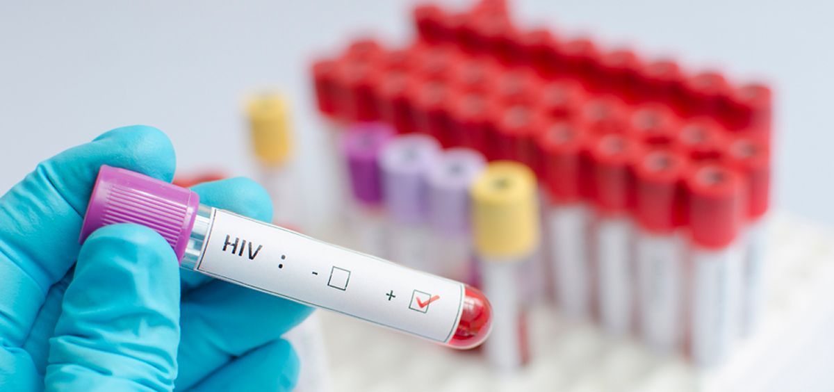 Casi el 50% de las nuevas infecciones por VIH son diagnósticos tardíos