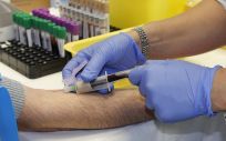 El primer análisis de sangre capaz de detectar melanomas
