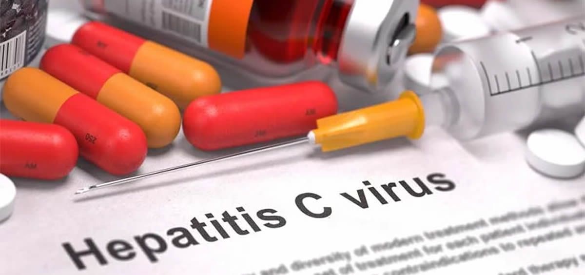 Hepatitis C (Foto: Pixabay)