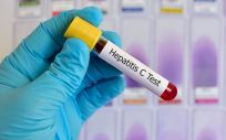 En España ya se han tratado más de 110.000 pacientes de hepatitis C con los nuevos fármacos