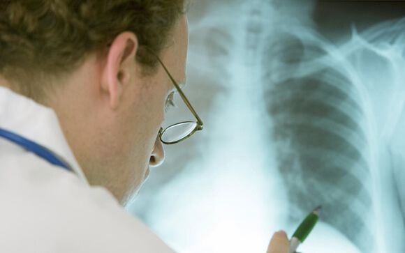 La asociación entre EPOC y enfisema potencia el riesgo de desarrollar cáncer de pulmón