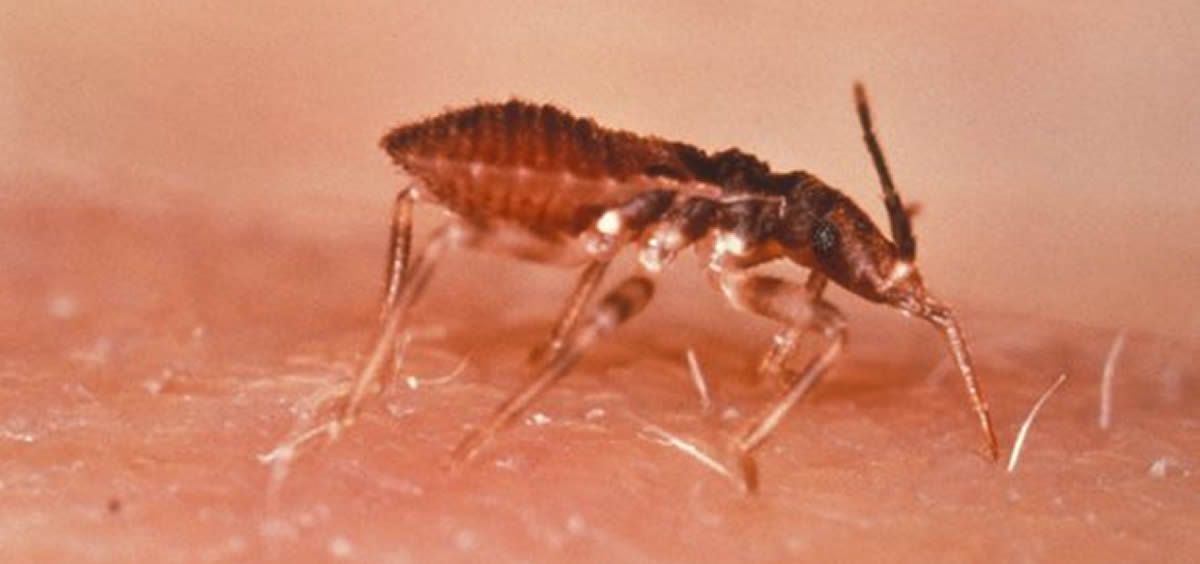 El Chagas es una enfermedad producida por el parásito Trypanosoma cruzi, que se trasmite por un insecto 
