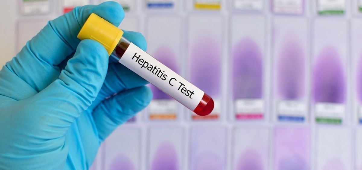 Hepatitis C (Foto: Pixabay)