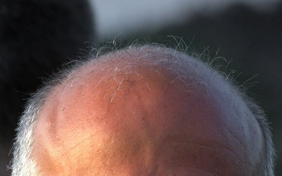 Diez consejos contra la caída del pelo