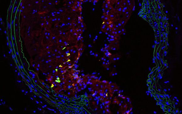 Identifican a las células nestina  como esenciales en la respuesta inflamatoria en la aterosclerosis