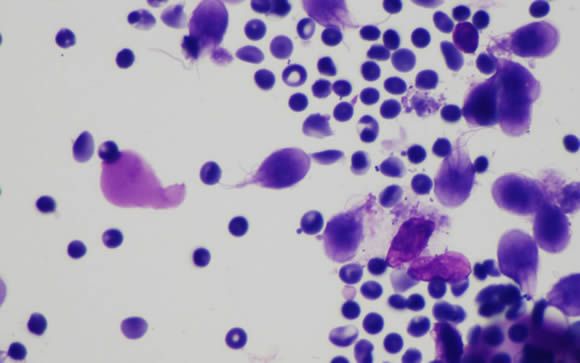 Identifican la estructura celular de un parásito causante de diarrea infantil