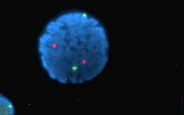 Núcleo de un linfocito marcado con diversos colorantes fluorescentes.