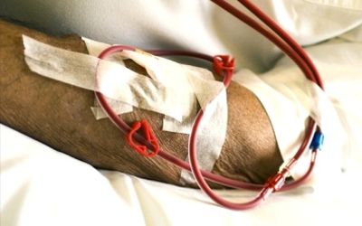 Más de 50.000 personas padecen poliquistosis renal autosómica dominante en España
