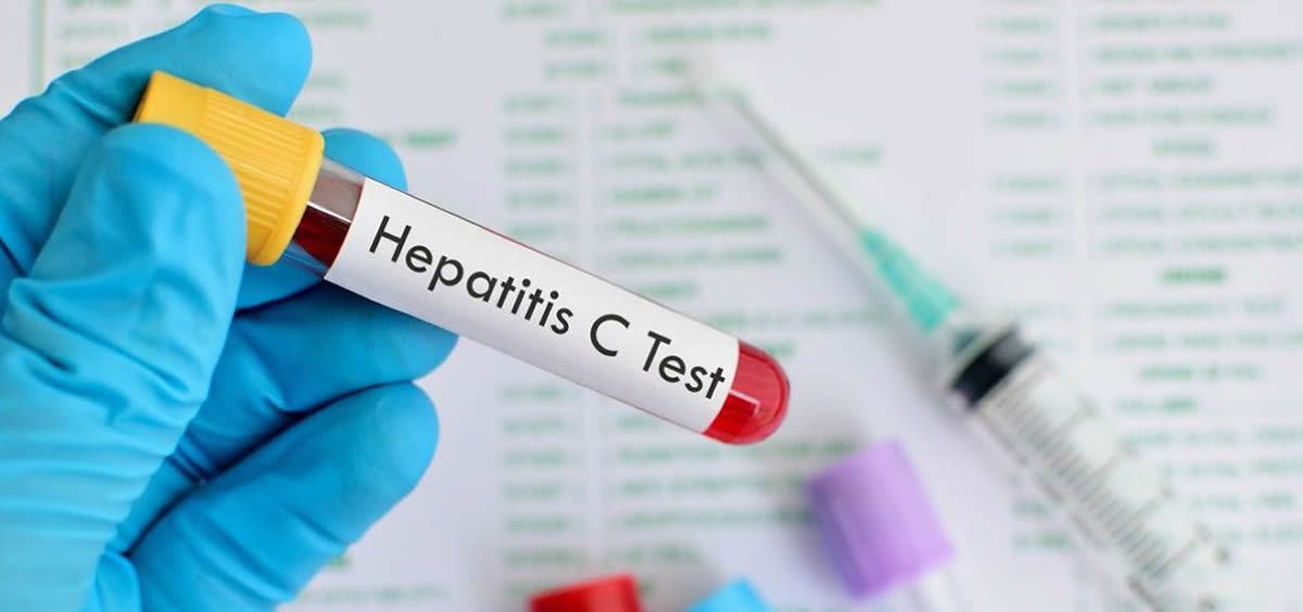 La infección activa por hepatitis C tiene una prevalencia en España de 0,22% (Foto. Pixabay)