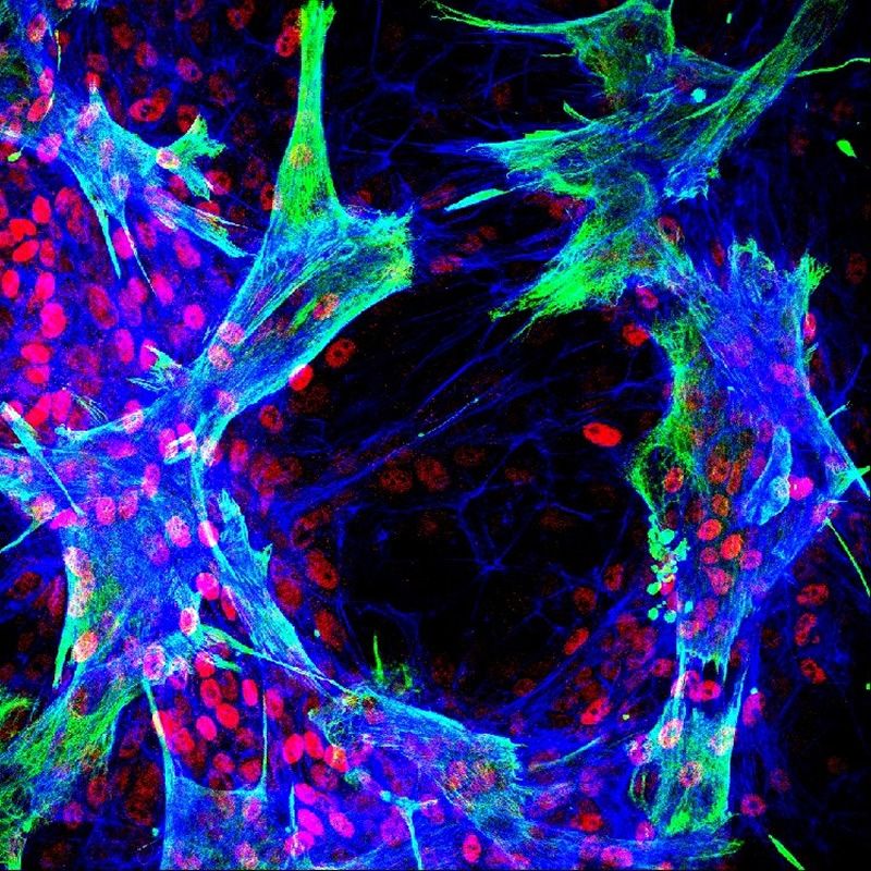 Imagen de inmunofluorescencia que muestra células estrelladas hepáticas primarias humanas que interactúan con células progenitoras hepáticas bipotentes in vitro