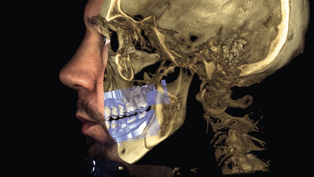 El aparato permite crear una imagen en 3 dimensiones de los huesos faciales, piel y dientes