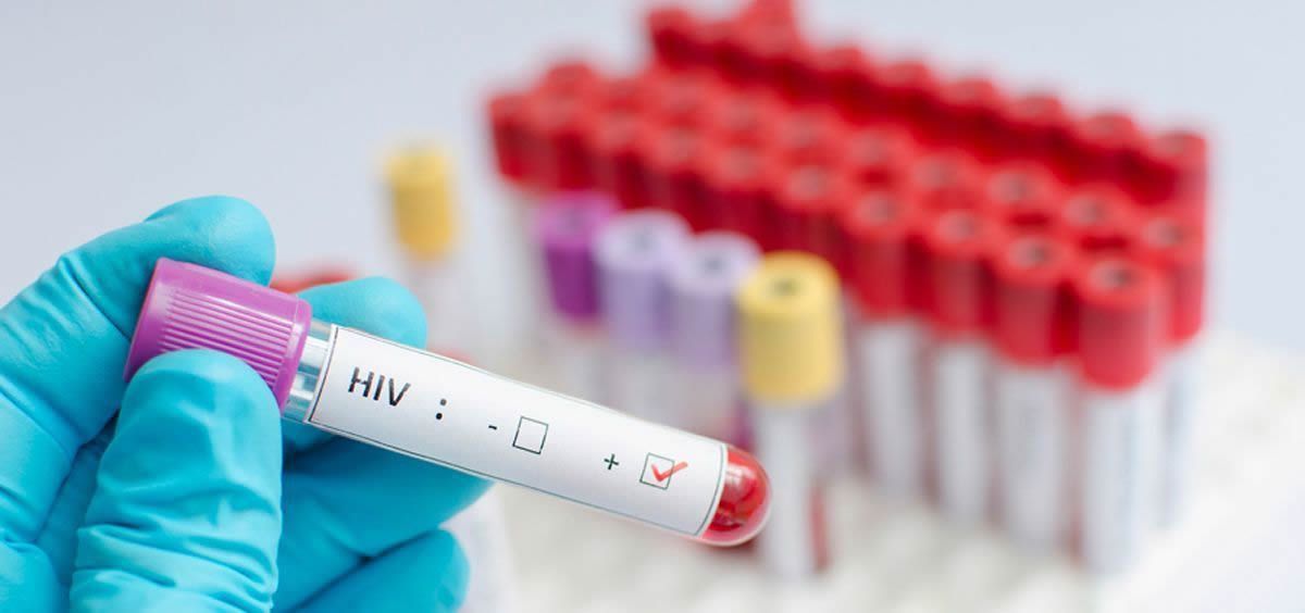 En torno al 72,8 % de las personas que viven con VIH en España habría alcanzado supresión viral