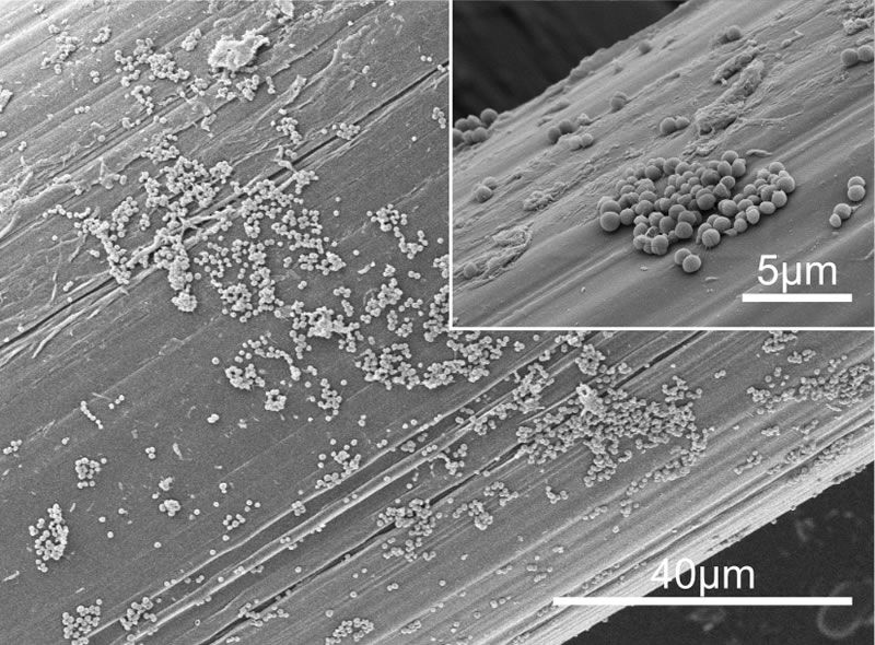 Micrografías SEM del biofilm de S. aureus formado en la superficie de la malla quirúrgica