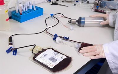 Primer tratamiento en España de una anemia congénita con células madre